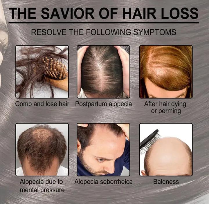 Uptown La anti Hair loss Serum