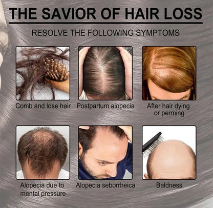 Uptown La anti Hair loss Serum