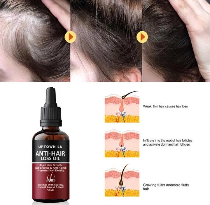 Uptown La anti Hair loss Serum